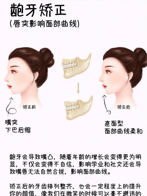 什么脸型适合牙齿矫正（这4类人做牙齿矫正脸型变化最大）