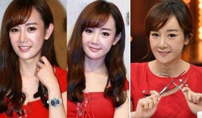 ​张檬整容记图片 判若二人，脸色坚硬可谓整容波折的背后讲义