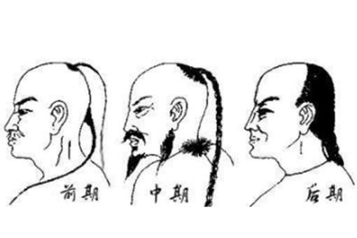 清朝强制留辫子,那秃顶的人怎么办?