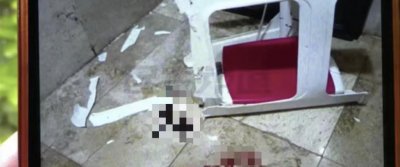 ​男子在医院上厕所隐私部位被割伤缝20多针，医院要赔偿吗？律师解读