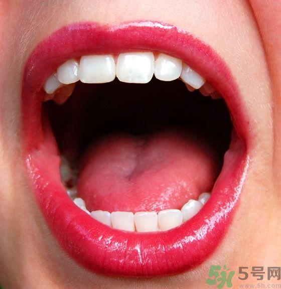 嘴里有溃疡怎么办？口腔溃疡吃什么好？