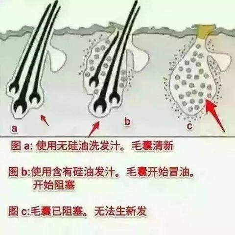“范冰冰洗头法”了解一下？还有细软发质打理方法大总结！