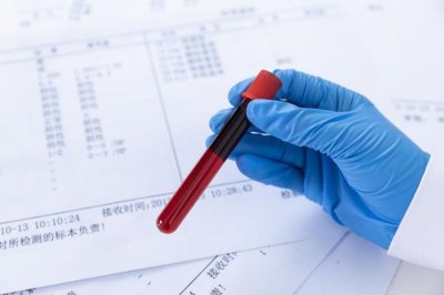 ​公务员体检血常规刷人标准