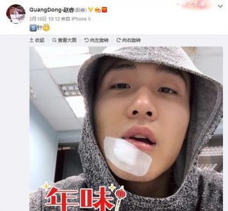 ​赵睿过年受伤破相 回复：“给我滚”