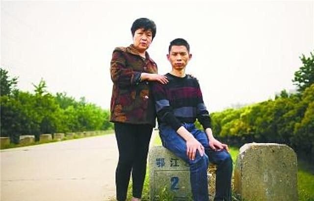 整容失败后的抑郁症案（12年前割肝救儿的）(14)