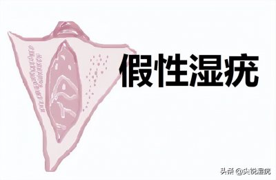 ​真假尖锐疣体图文鉴别